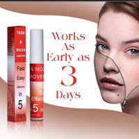 Tags & Moles Remover