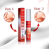 Tags & Moles Remover